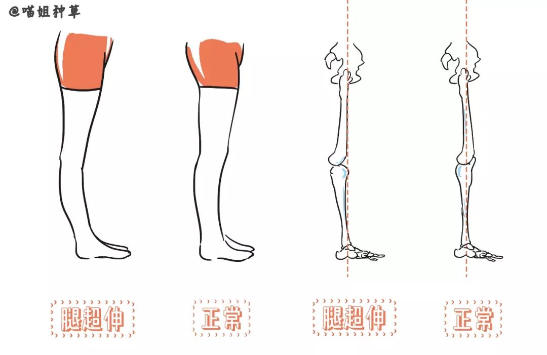 什么肌骨成语_成语故事图片(2)