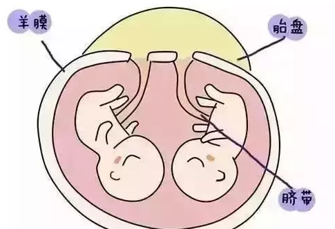 有这4个特点的妈妈更容易怀双胞胎