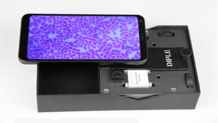 SmartMicroOptics推Diple镜头平台：智能手表秒变显微镜