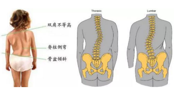 怎么趴着不伤脊椎 d7b5e27c5d4f4a1c810caa0beb7bd32f.jpeg