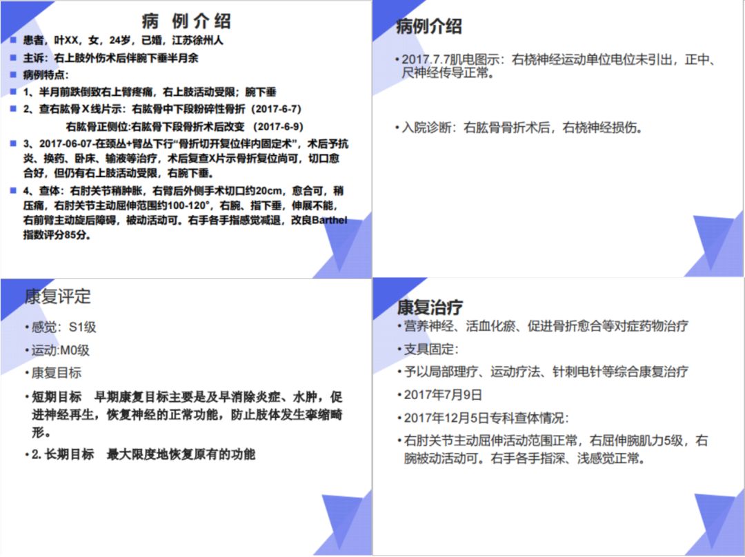 桡神经损伤康复训练 d923448aa7bf4a099c3d6edae2ffc454.jpeg
