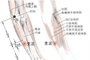 艾灸支正穴 可治咳嗽气喘,腰背疼痛艾灸支正穴 可治咳嗽气喘,腰背疼痛