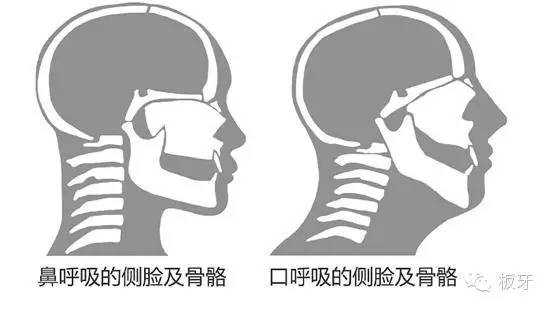 「小学生微试题」孩子脸越长越丑，可能因为一个坏习惯！家长必须要知道