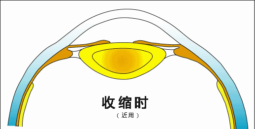 如何让眼睛变得灵活 7b1dafde3f2c48aeba75cf4302fd7bf8.gif