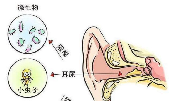 美食这点事：原创宝宝的耳朵能不能掏| 有耳屎怎么办? 听听儿科医生怎么说!