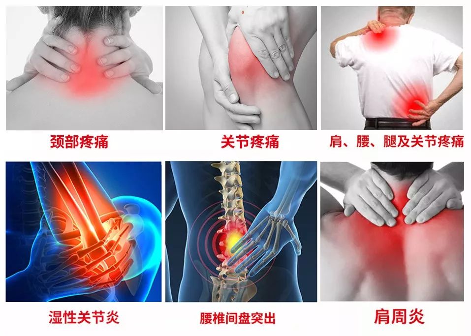 好消息仁和药业开发出治疗关节痛新膏贴1天见效月销6万