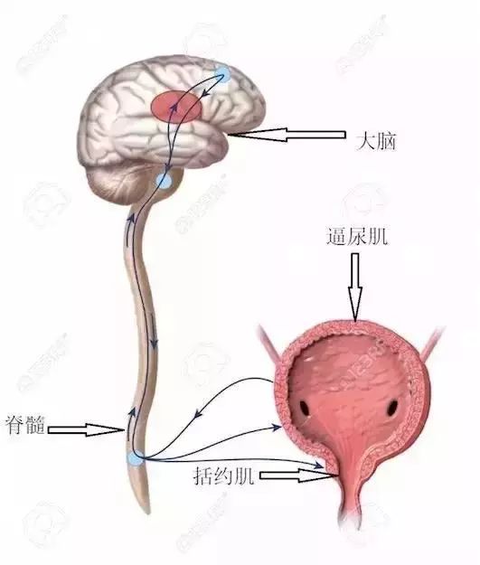 膀胱造瘘什么原理_膀胱造瘘图片(2)