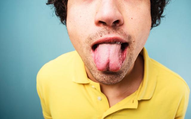 吃中药舌苔黄是怎么回事