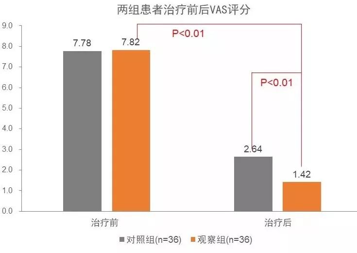 偏头痛的原理_神经末梢炎(2)