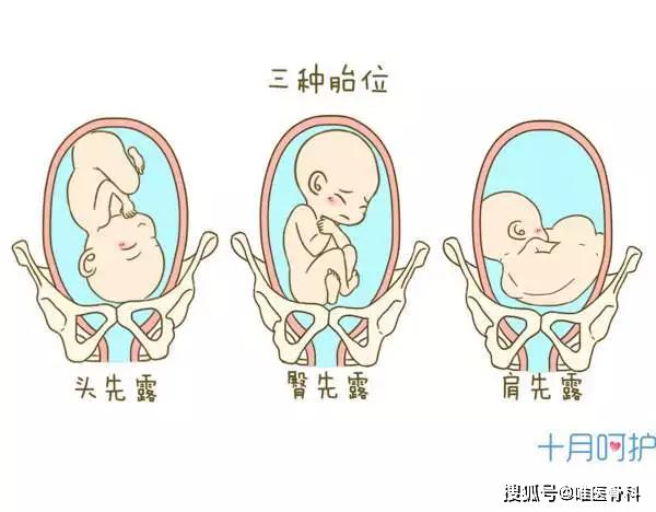 "摸一摸"可以判断胎儿的位置?妈妈们切记不要乱摸!