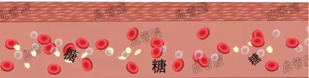 所谓高血糖,就是指体内血糖含量超标,严重了就是糖尿病.