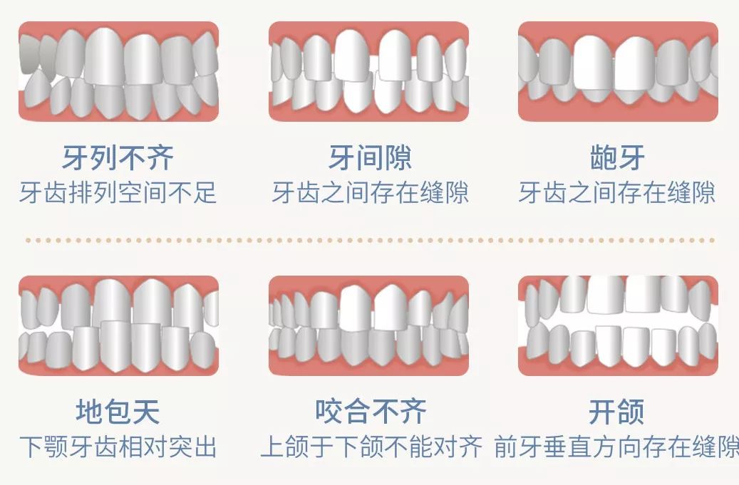 上火了牙齿松动怎么办