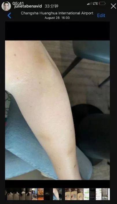 高以翔死因公布张咪确诊癌症晚期 蒋劲夫否认家