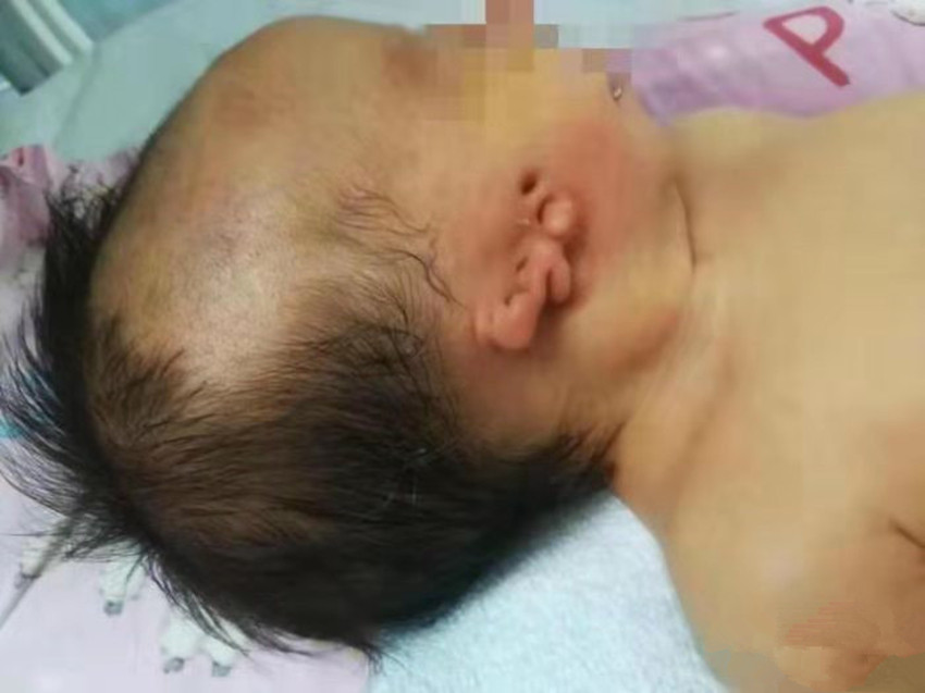 什么时候能看出来小孩有没有畸形 2dc6d0479917438fb97a62d96eb29c81.jpeg