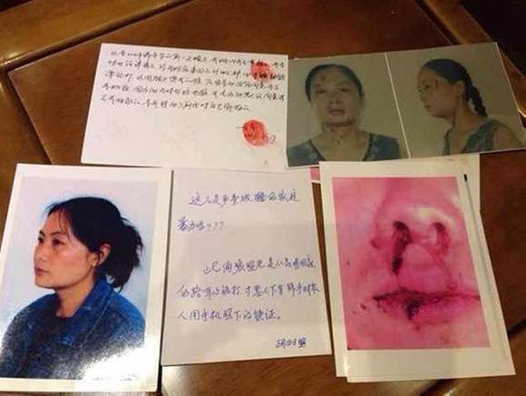 家暴行拘20日，算不算惩罚过轻？