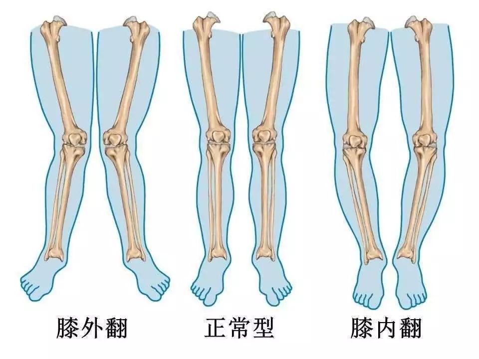 膝胸卧位原理是什么意思_膝卧位是什么姿势图片