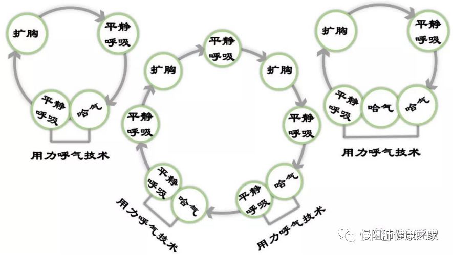 如何更有效的排痰主动循环呼吸技术帮你解决患者咳痰痛苦