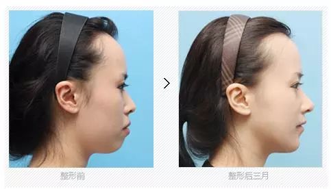 怎么才能变成大脸型 4d82a7e106944c4793061d36e13d400a.jpeg