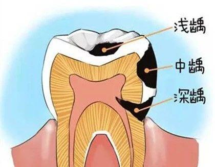 怎么才能让牙神经不疼 c6f35889a4e24fc5b266c646a84a1c8a.jpeg