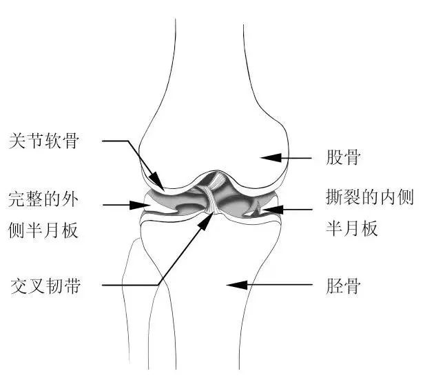 成语承什么膝_成语故事图片