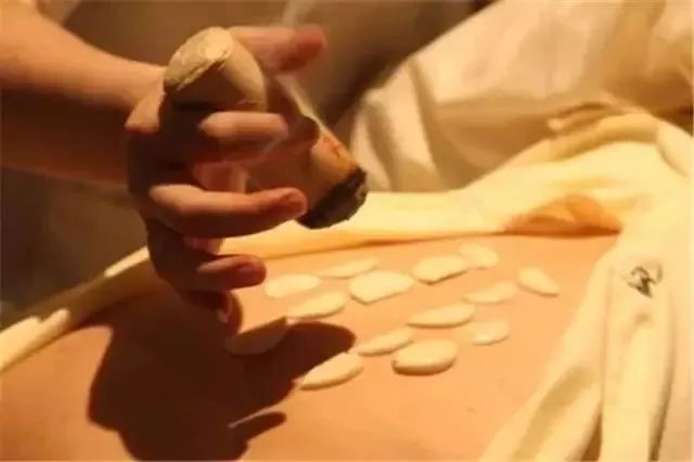 中医外治法有哪几大类 d09c4c0994394b80af10f2237999367f.jpeg