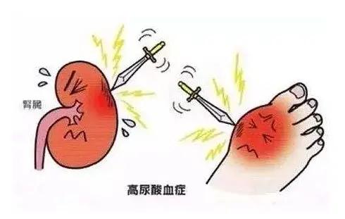 尿酸高如何调理好?