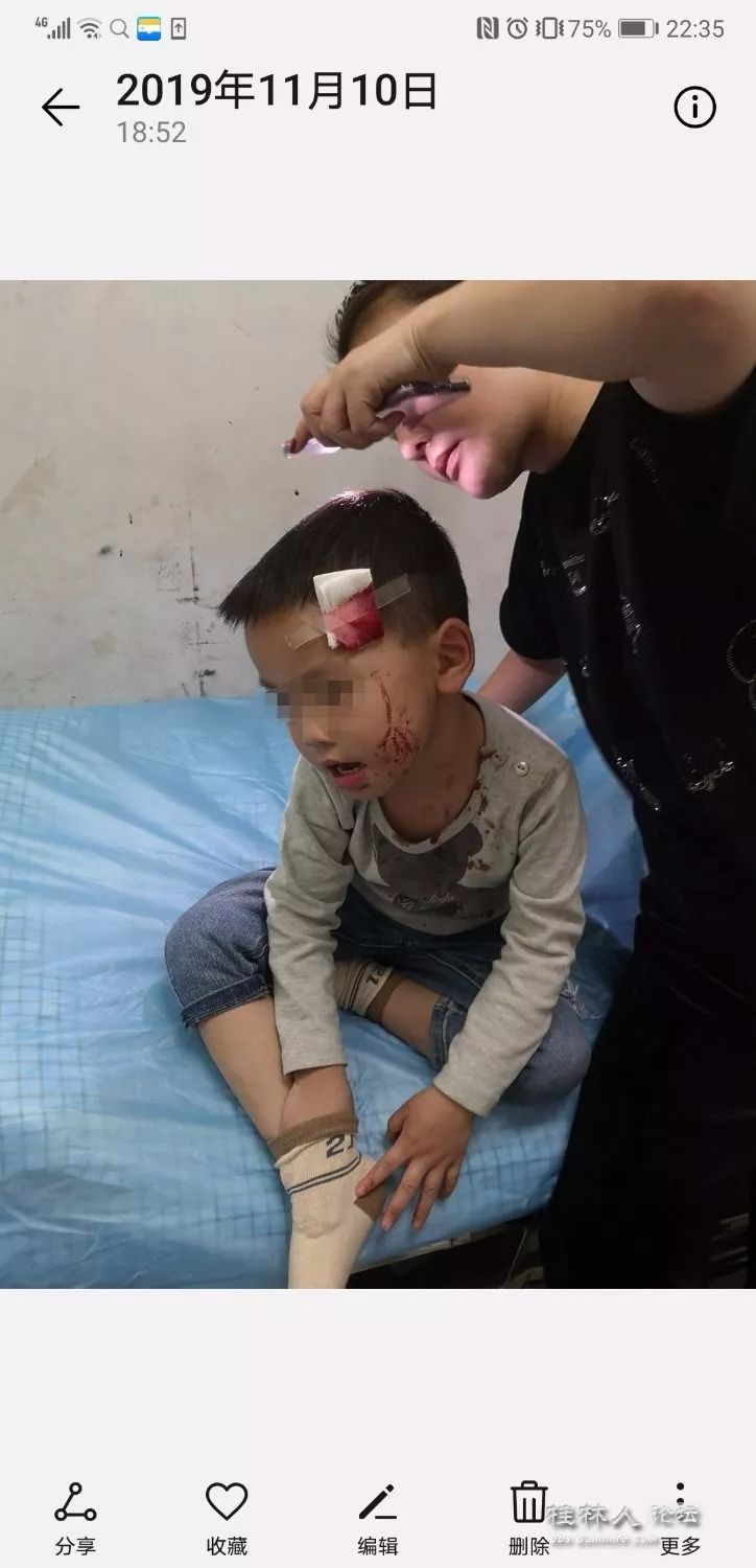 社会丨桂林一小孩被炸伤血流不止医生一行为气的家长发抖