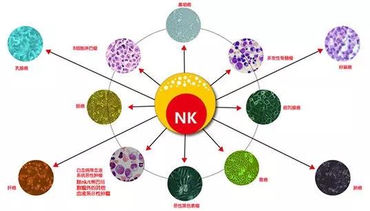 301医院nk细胞免疫疗法开赴癌症治疗新征程