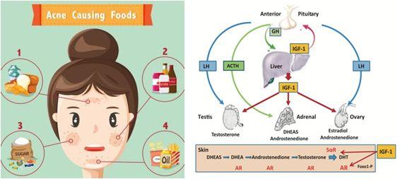 吃什么东西能减少痘痘 017f681f4073478eb7de0016251c93d6.jpeg