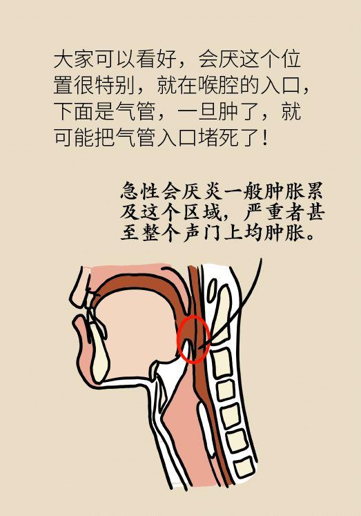 警惕女孩嗓子疼险些丧命遇到这种咽痛必须注意