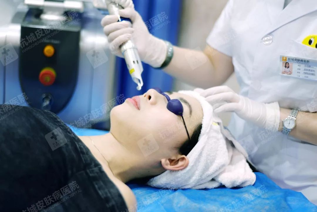 最后,进行激光热治疗 生物冷养祛斑 缓解皮肤敏感后,由于敏感肌肤较