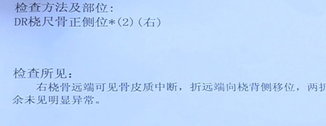 事发当天就被包扎了起来是右桡骨远端骨折孩子的手从医院检查报告单中