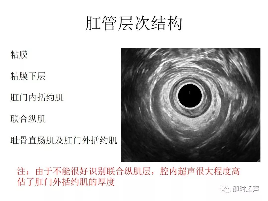 2,低位直肠癌(腹膜返折处以下距肛缘约7-8cm的癌灶)所占比例最高,约占