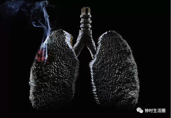 30年烟龄男子捐肺,医生取出后没人要!