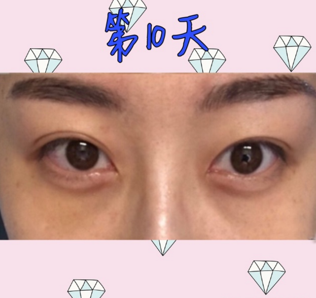25dd05978544448887f451145ad2074d.png