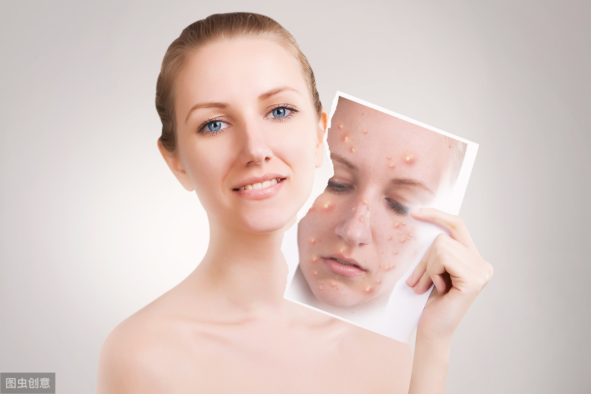 多少岁开始抗衰老 82bb556e939440209455ccd1286ab76e.jpeg