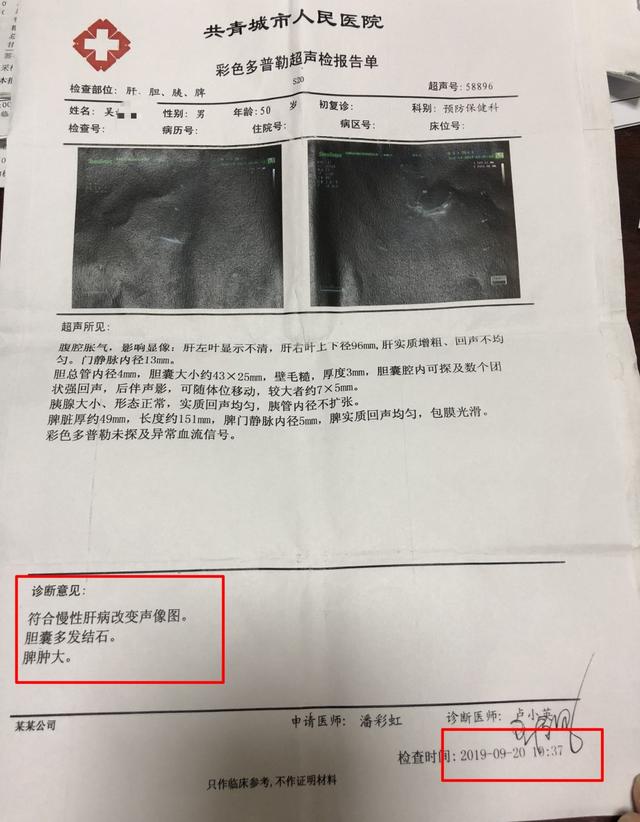 钟伟医生健康谈:乙肝转肝硬化腹水患者,用中药治疗后