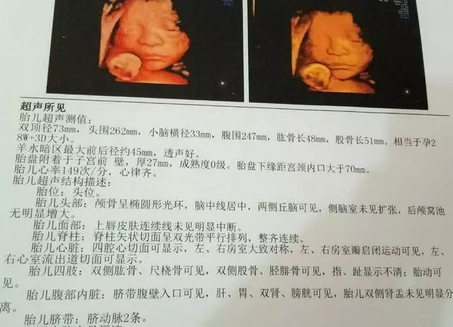 做四维彩超却不做这一步简直就是白花钱还不如选择三维彩超