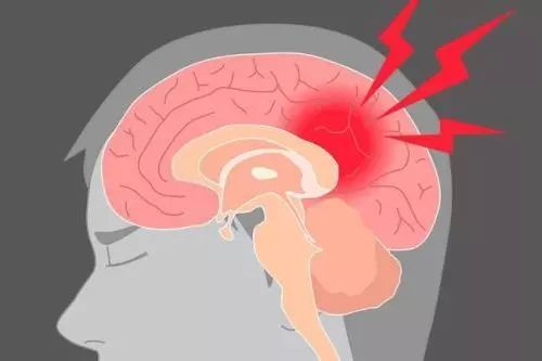 洗澡后血压会下降吗 bf4eba936288400089bea02d6d922901.jpeg