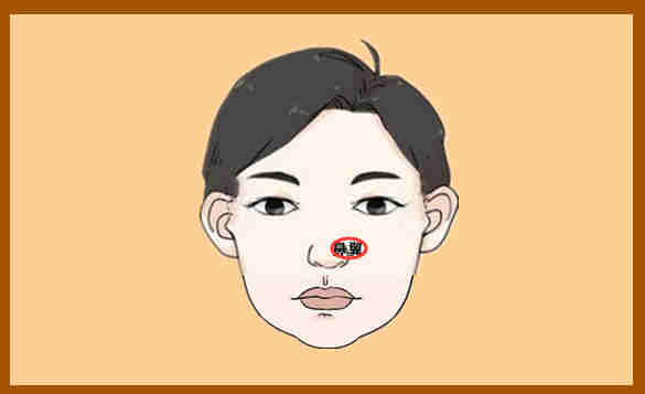 鼻翼有痣会影响家庭的稳定,所以鼻翼有痣会破财,女人鼻翼有痣预示有
