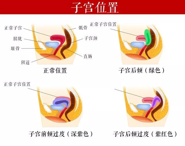 子宫后位是什么意思4种表现说明子宫后位