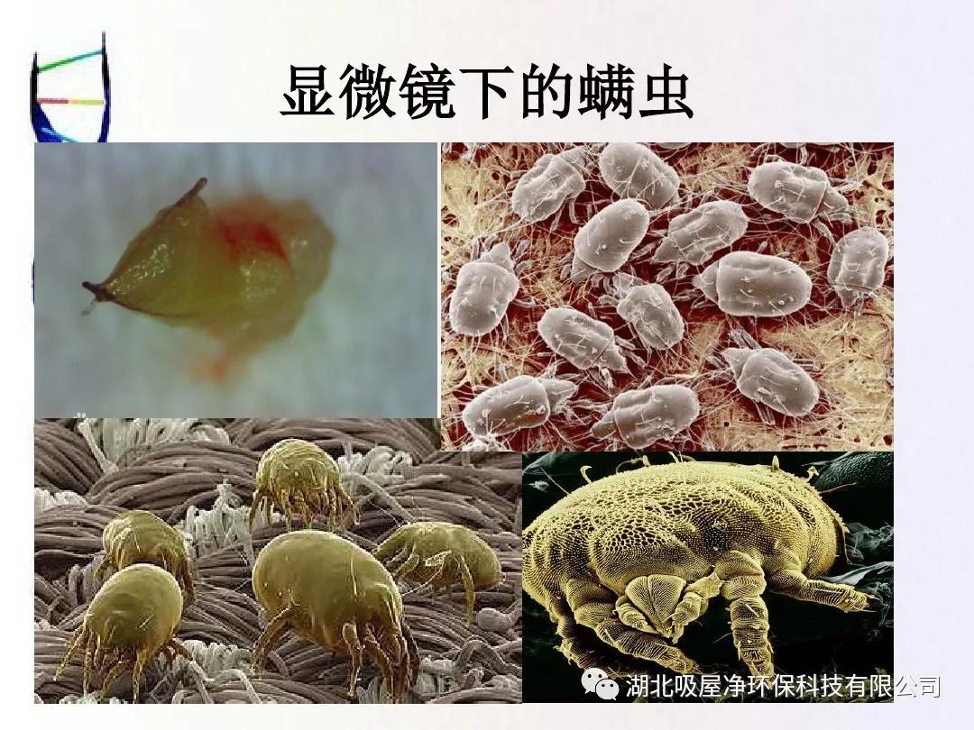 螨虫以我们毛囊内的皮脂为食物,同时会吃掉毛囊内的其他细菌.