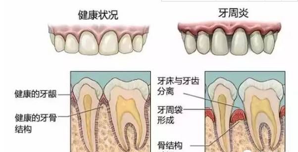 总塞牙怎么办