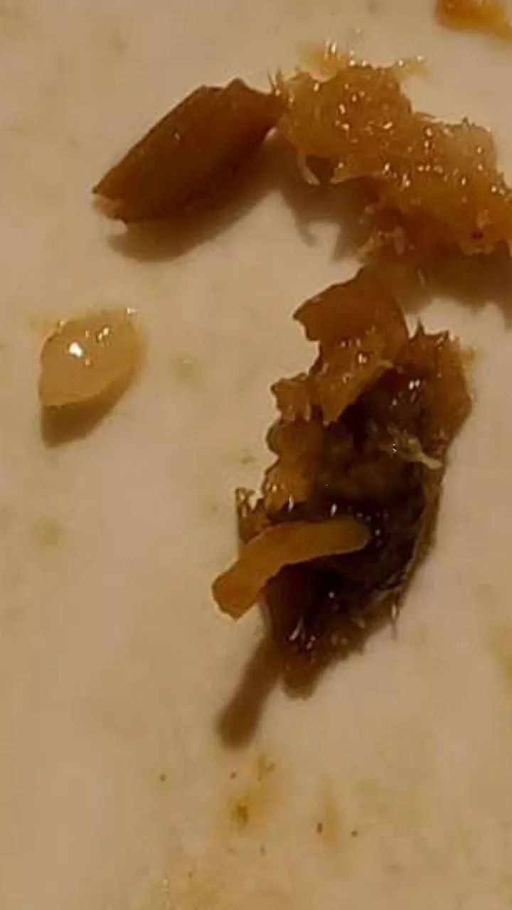 网爆:在东园小馆吃饭竟然吃到了毛发和虫子,服务员还.