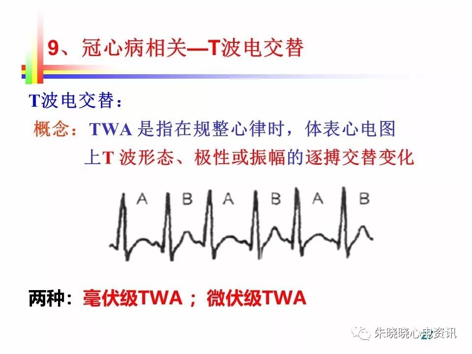 心脏猝死预警心电图(ppt)