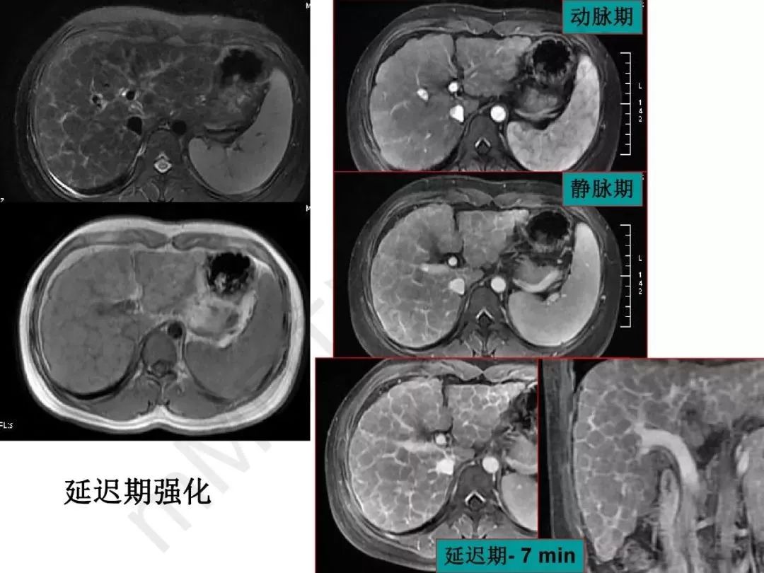 肝脏gdp值_肝脏位置(2)
