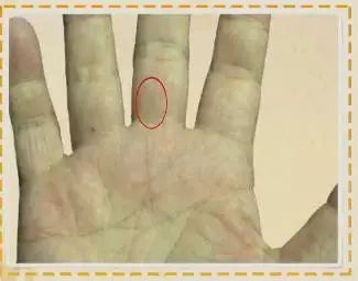 什么样的手指是健康的 a51160c80d1f4756856fce860d3c2200.jpeg