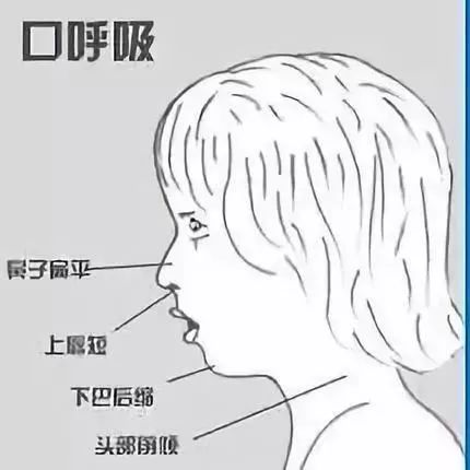 这是孩子成长过程中最有价值的投资——mrc儿童早期干预性矫正