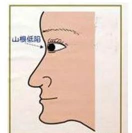 33a2a748943d4ebd881cf3b34b0a72a7.jpeg