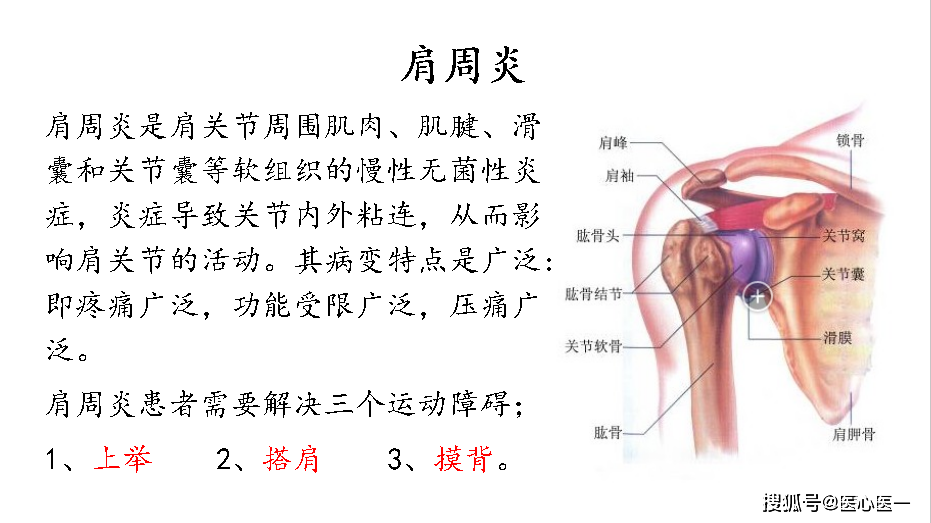 叶颖华 | 肌筋膜松懈术 | 肩背臀上肢疾病 | 图解大全